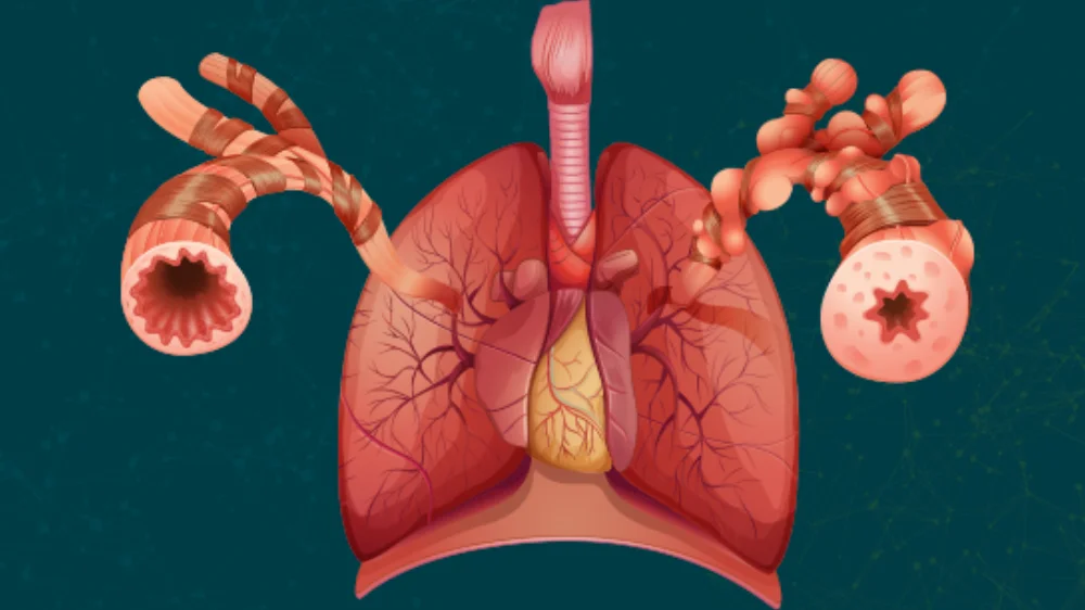 Interstitial Lung Diseases